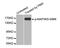 Mitogen-Activated Protein Kinase Kinase Kinase 5 antibody, MBS128503, MyBioSource, Western Blot image 