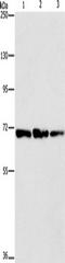 Phenylalanyl-TRNA Synthetase Subunit Beta antibody, TA349533, Origene, Western Blot image 