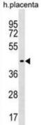 Zinc Finger Protein 662 antibody, abx030852, Abbexa, Western Blot image 