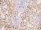 Glycine-N-Acyltransferase Like 1 antibody, 205090-T08, Sino Biological, Immunohistochemistry paraffin image 