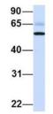 Phosphoinositide-3-Kinase Regulatory Subunit 5 antibody, NBP1-56922, Novus Biologicals, Western Blot image 