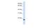 Sodium/Potassium Transporting ATPase Interacting 1 antibody, GTX45984, GeneTex, Western Blot image 