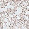 Zinc Finger Protein 141 antibody, 15-734, ProSci, Immunohistochemistry frozen image 
