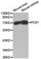 Phosphoenolpyruvate Carboxykinase 1 antibody, TA327236, Origene, Western Blot image 