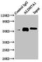 Aldehyde Dehydrogenase 7 Family Member A1 antibody, LS-C669720, Lifespan Biosciences, Immunoprecipitation image 