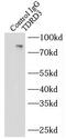 Tudor Domain Containing 3 antibody, FNab08578, FineTest, Immunoprecipitation image 