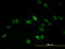 Transcription Factor EB antibody, LS-C198513, Lifespan Biosciences, Immunofluorescence image 