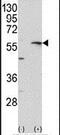 Matrix Metallopeptidase 13 antibody, PA5-13182, Invitrogen Antibodies, Western Blot image 