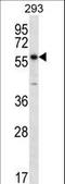 Patatin Like Phospholipase Domain Containing 1 antibody, LS-C158690, Lifespan Biosciences, Western Blot image 