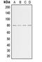 G Protein-Coupled Receptor Kinase 2 antibody, orb213536, Biorbyt, Western Blot image 