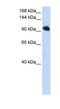 Splicing Factor SWAP antibody, NBP1-57466, Novus Biologicals, Western Blot image 