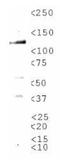 Transient Receptor Potential Cation Channel Subfamily M Member 8 antibody, NBP1-97311, Novus Biologicals, Western Blot image 