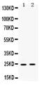 High Mobility Group Box 2 antibody, PB10002, Boster Biological Technology, Western Blot image 