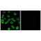 ATP Synthase F1 Subunit Delta antibody, A10129, Boster Biological Technology, Immunohistochemistry paraffin image 