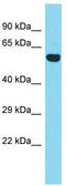 Coiled-Coil Domain Containing 149 antibody, TA333460, Origene, Western Blot image 