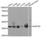 Aldose reductase antibody, LS-C748960, Lifespan Biosciences, Western Blot image 