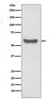 Immunoglobulin Heavy Constant Alpha 1 antibody, M07514, Boster Biological Technology, Western Blot image 