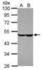Carbohydrate Sulfotransferase 7 antibody, PA5-31763, Invitrogen Antibodies, Western Blot image 