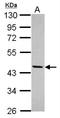 Cyclin Dependent Kinase 7 antibody, NBP2-15847, Novus Biologicals, Western Blot image 