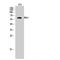 AKT Serine/Threonine Kinase 2 antibody, LS-C381969, Lifespan Biosciences, Western Blot image 