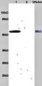 Measles virus antibody, orb10672, Biorbyt, Western Blot image 