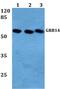 Growth Factor Receptor Bound Protein 14 antibody, PA5-75399, Invitrogen Antibodies, Western Blot image 