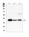 Major Histocompatibility Complex, Class I-Related antibody, A00618-1, Boster Biological Technology, Western Blot image 
