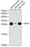 Glutathione Peroxidase 4 antibody, 14-907, ProSci, Western Blot image 