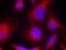 Myristoylated Alanine Rich Protein Kinase C Substrate antibody, orb15025, Biorbyt, Immunocytochemistry image 
