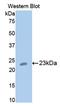 Cartilage Oligomeric Matrix Protein antibody, LS-C700161, Lifespan Biosciences, Western Blot image 