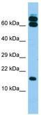 B9 domain-containing protein 2 antibody, TA331714, Origene, Western Blot image 