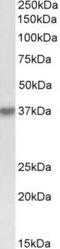 Hematopoietic SH2 domain-containing protein antibody, TA311551, Origene, Western Blot image 