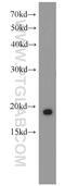 Retinol Binding Protein 7 antibody, 14541-1-AP, Proteintech Group, Western Blot image 