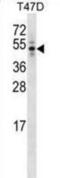 CEP44 antibody, abx030215, Abbexa, Western Blot image 