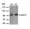 Catenin Alpha 1 antibody, 79-620, ProSci, Western Blot image 