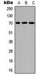 Interleukin 2 Receptor Subunit Beta antibody, LS-C359030, Lifespan Biosciences, Western Blot image 