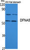 Gasdermin E antibody, STJ96411, St John