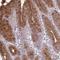 Matrix Metallopeptidase 14 antibody, NBP2-38649, Novus Biologicals, Immunohistochemistry frozen image 