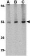 Cytokine Receptor Like Factor 2 antibody, GTX85052, GeneTex, Western Blot image 