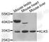 Kallikrein Related Peptidase 5 antibody, A2991, ABclonal Technology, Western Blot image 