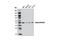 RuvB Like AAA ATPase 2 antibody, 8959S, Cell Signaling Technology, Western Blot image 