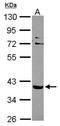 Glucosylceramidase Beta 3 (Gene/Pseudogene) antibody, orb73378, Biorbyt, Western Blot image 