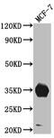 Insulin Like Growth Factor Binding Protein 2 antibody, CSB-RA225697A0HU, Cusabio, Western Blot image 