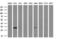 NSE2 (MMS21) Homolog, SMC5-SMC6 Complex SUMO Ligase antibody, M06693, Boster Biological Technology, Western Blot image 