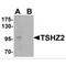 Teashirt Zinc Finger Homeobox 2 antibody, MBS150449, MyBioSource, Western Blot image 
