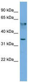 Fibronectin Type III Domain Containing 8 antibody, TA344990, Origene, Western Blot image 