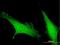 Calcium Release Activated Channel Regulator 2A antibody, H00084766-B01P, Novus Biologicals, Immunocytochemistry image 