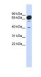 Mannosidase Alpha Class 1A Member 2 antibody, orb325294, Biorbyt, Western Blot image 
