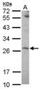 SUMO Peptidase Family Member, NEDD8 Specific antibody, NBP2-20296, Novus Biologicals, Western Blot image 