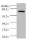 Polymeric Immunoglobulin Receptor antibody, LS-C285579, Lifespan Biosciences, Western Blot image 